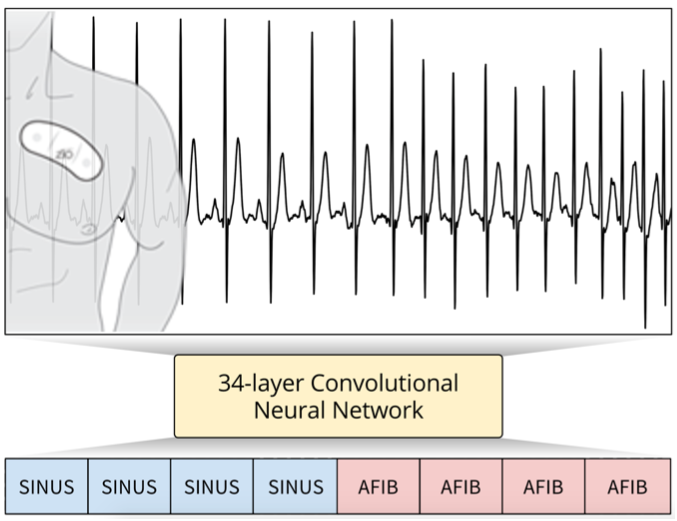 arrhythmia_cnn